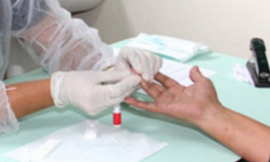 Projeto “Viva Melhor Sabendo” vai oferecer orientações e teste rápido para HIV nesta quinta