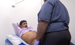 Após implante de pênis, homem faz cirurgia para diminuir o tamanho do órgão