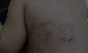 Mães tentam espancar mulher que chegou no João Lúcio com bebê violentado