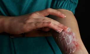 Fogos de artifício são os maiores responsáveis pelos acidentes no período junino