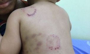 Caso de bebê torturado e violentado está sendo usado para aplicar golpes em Manaus