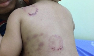  Adolescente que confessou ter estuprado e mordido bebê deve ser julgado em julho