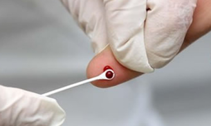 Campanha de Combate às Hepatites Virais inicia na próxima sexta