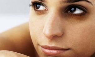 10 Soluções caseiras para acabar com as terríveis olheiras