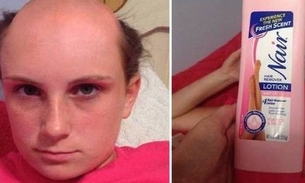 Jovem usa creme de depilação em vez de xampu e o resultado é hilário