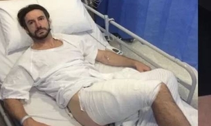   iPhone explode no bolso de atleta e causa queimaduras de 3º grau 