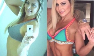 'Miss Plástica' surge irreconhecível em fotos antigas e revela quanto gastou em 13 plásticas