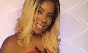   Ludmilla entrega atestado para não ir a show e acaba tendo cirurgia plástica descoberta 