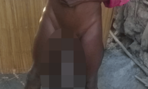 Homem sofre por ter pênis do tamanho de um bebê