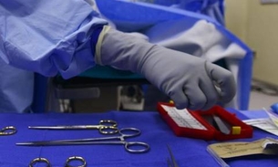 Cientista pode fazer o primeiro transplante de cabeça em 2017
