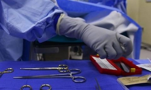 Cientista pode fazer o primeiro transplante de cabeça em 2017