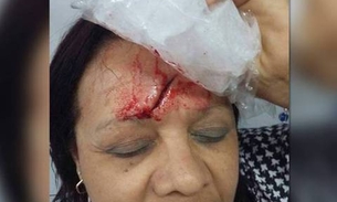 Aluno arremessa porta-lápis e fere vice-diretora no rosto