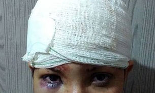  Mulher se finge de morta após ser espancada pelo ex 