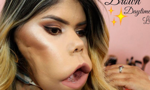 Jovem com doença rara surpreende a todos na internet