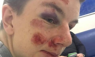 Autista é agredido por gangue e causa revolta 