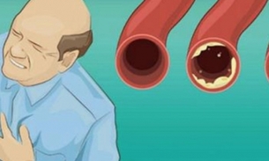 15 Alimentos que limpam artérias naturalmente e evita infarto