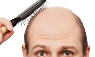 Se eu usar boné por muito tempo, vou ficar careca? 