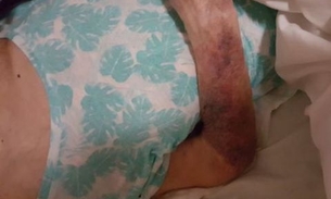 Idosa é agredida por cuidador dentro de asilo 