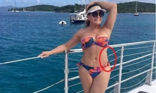 Susana Vieira posa de biquíni e algo chama atenção