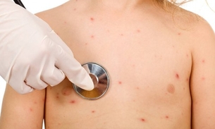 Chá de ‘Paciência’ ajuda na cura de doenças na pele 