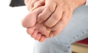 Fruta atua como inseticida natural e ajuda a eliminar o famoso 'bicho-de-pé'