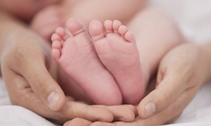 Bebê nasce com coração desenhado na testa e encanta internautas 