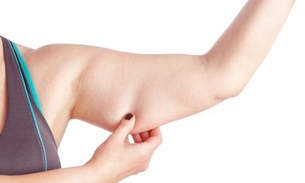 Queima calorias, trata obesidade e reduz o colesterol 