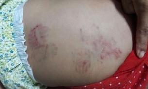 Bebê de 11 meses é agredida em creche particular
