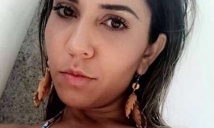  Mulher Melão enlouquece seguidores fazendo bronzeamento de esparadrapo: 'suadinha'
