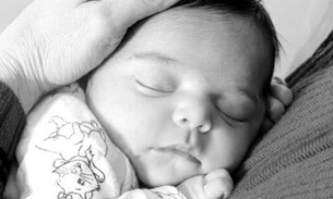 Mãe e filha dão à luz bebês com microcefalia