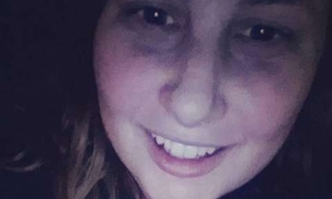 Jovem tem que amputar o pé mas ninguém pode imaginar o que ela fez com o esqueleto depois