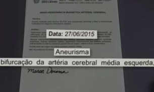 Defesa de Cunha apresenta laudo que atesta aneurisma