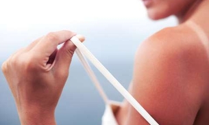 Conheça alternativa para tratar queimaduras do sol e assaduras