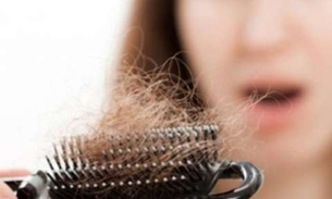 Óleo de Mamona combate queda de cabelo