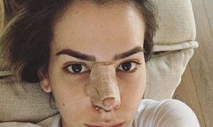  Adriana Sant'Anna faz segunda plástica no nariz e mostra foto pós-cirurgia