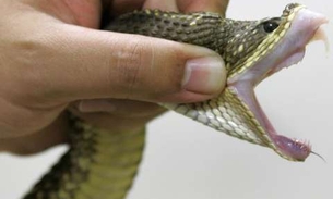 Veneno de cobra é usado no controle da hipertensão arterial 