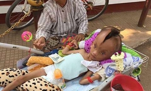 Criança surpreende médicos com rachadura surreal na cabeça