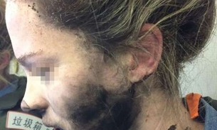 Mulher sofre queimaduras após explosão de fones de ouvido durante voo