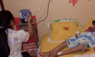 Adriano Jorge faz primeiro atendimento domiciliar para paciente com doença rara no AM