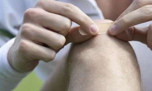 Com efeito analgésico, planta é usada como pomada para untar feridas 