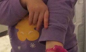  Casal se descuida e criança de 2 anos usa brinquedo sexual como se fosse relógio