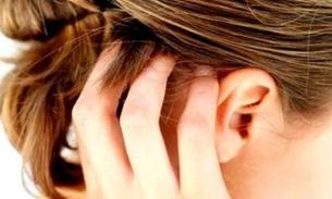 Após contrair piolho, criança é internada com infestação de larvas de moscas na cabeça