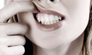 Cicatrizante e antisséptica, planta trata aftas e gengivites 