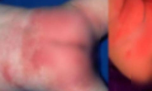 Substâncias tóxicas e cancerígenas são encontradas em fraldas de bebês