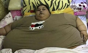  'Mulher mais pesada do mundo', perde 250 kg em dois meses após cirurgia bariátrica