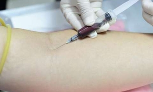 Exame de sangue detecta ressurgimento de câncer com 1 ano de antecedência