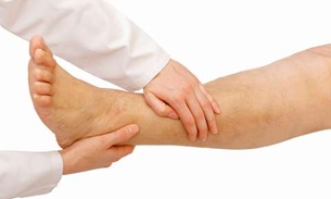 Alivie rapidamente inchaço dos pés e pernas com estes alimentos