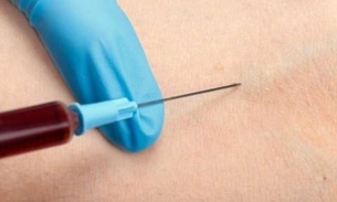 Jejum prolongado não é mais exigido para exames de colesterol e triglicérides