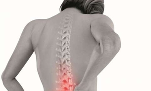 Conheça alimentos ricos em Vitamina D que ajudam evitar osteoporose 