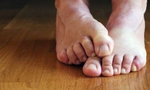 Planta ornamental trata doenças causadas por fungos na pele e unhas 